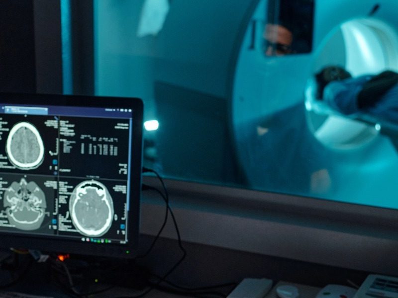 Begin Rant: Radiology deserts in regional NSW are a policy failure costing millions